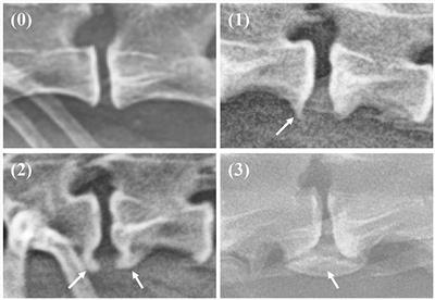 Detection of spondylosis deformans in thoracolumbar and lumbar lateral X-ray images of dogs using a deep learning network